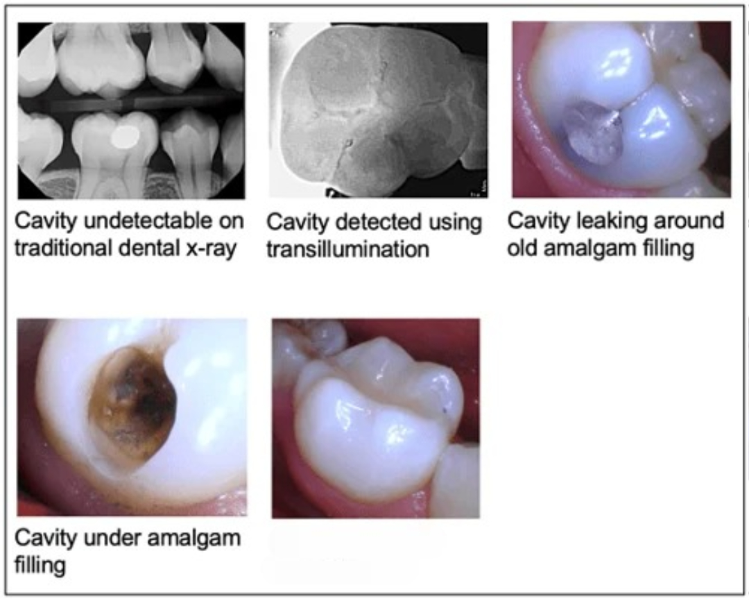 Cavity