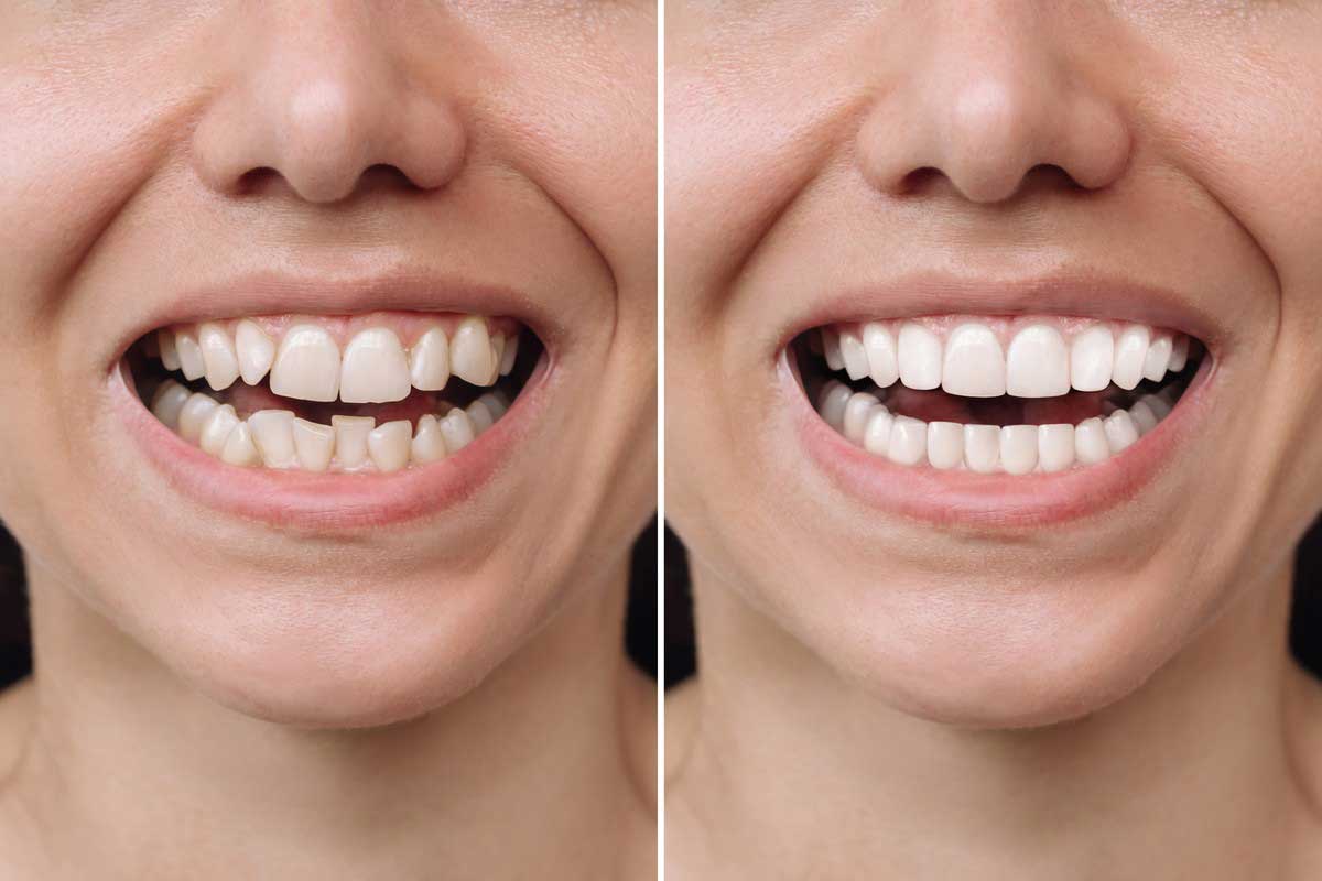 Dr. Jyotika Kaushik Goodman is Top 1% Invisalign provider in the country!